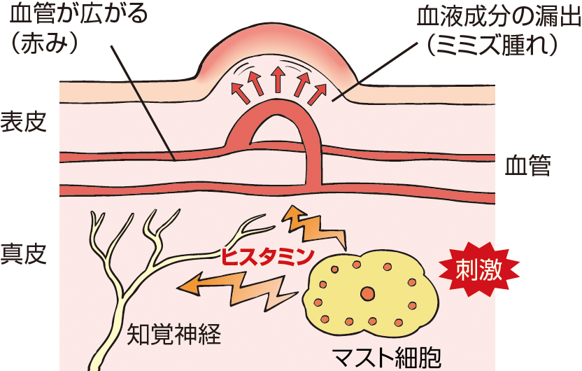 解説図