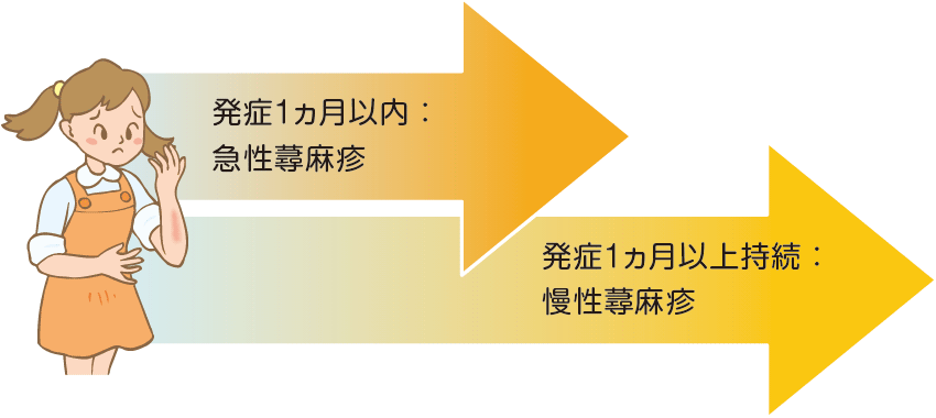 発症1ヵ月以内：急性蕁麻疹、発症1ヵ月以上持続：慢性蕁麻疹