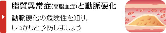 脂質異常症（高脂血症）と動脈硬化｜動脈硬化の危険性を知り、しかりと予防しましょう